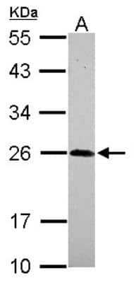 Western Blot: beta-NGF Antibody [NBP2-19536]