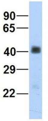 Western Blot: beta Sarcoglycan Antibody [NBP1-59751]