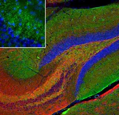 Immunocytochemistry/ Immunofluorescence: beta-Synuclein Antibody [NBP3-05529]