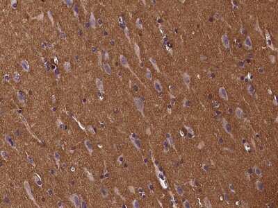 Immunohistochemistry-Paraffin: beta-Synuclein Antibody [NBP2-97152]