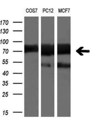 Western Blot: beta-TrCP1/BTRC Antibody (OTI2H2) [NBP2-46588]