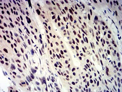 Immunohistochemistry: beta-TrCP1/BTRC Antibody (4C5D8) - BSA Free [NBP2-61712]