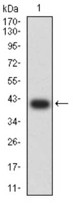 Western Blot: beta-TrCP1/BTRC Antibody (4C5D8)BSA Free [NBP2-61712]