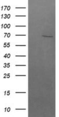 Western Blot: beta-TrCP1/BTRC Antibody (OTI2H2)Azide and BSA Free [NBP2-71402]