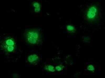 Immunocytochemistry/ Immunofluorescence: beta-TrCP1/BTRC Antibody (OTI3D5) - Azide and BSA Free [NBP2-71401]