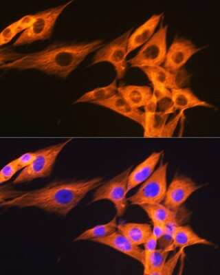 Immunocytochemistry/ Immunofluorescence: beta Tubulin Antibody (4E9G8) [NBP3-15439]