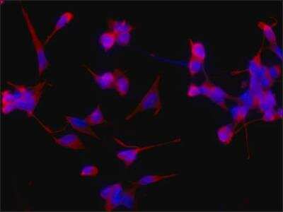 Immunocytochemistry/ Immunofluorescence: beta Tubulin Antibody (D66) [NB600-1514]