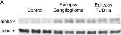 Western Blot: beta Tubulin Antibody (D66) [NB600-1514]