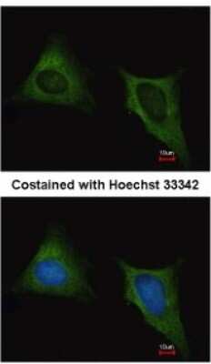 Immunocytochemistry/ Immunofluorescence: beta Tubulin Antibody [NBP2-15584]