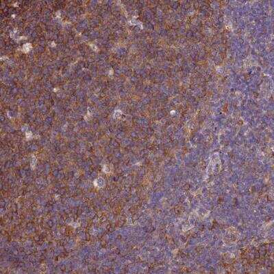 Immunohistochemistry-Paraffin: beta Tubulin Antibody [NBP2-54728]