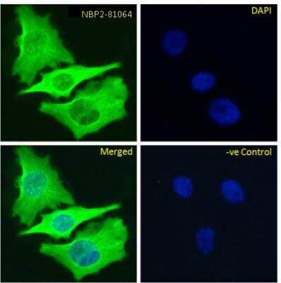 Immunocytochemistry/ Immunofluorescence: beta Tubulin Antibody (S11B) - Chimeric - Azide and BSA Free [NBP2-81064]