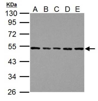 Western Blot: beta Tubulin Antibody [NBP2-15584]