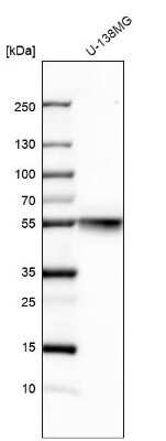 Western Blot: beta Tubulin Antibody [NBP2-54728]