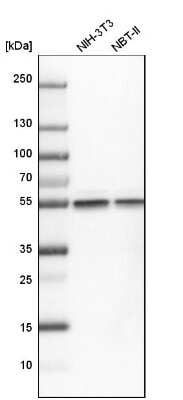 Western Blot: beta Tubulin Antibody [NBP2-54728]