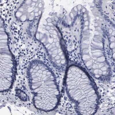 Immunohistochemistry-Paraffin: beta ureidopropionase Antibody [NBP1-89918]