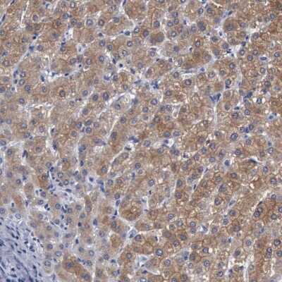 Immunohistochemistry-Paraffin: beta ureidopropionase Antibody [NBP1-89918]