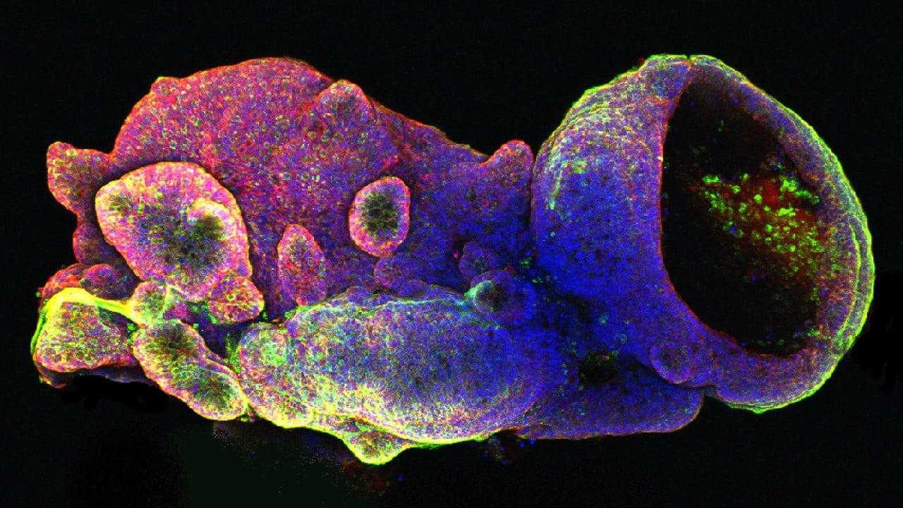 Human Descending Colon Organoid Cultured Using Cultrex UltiMatrix RGF BME