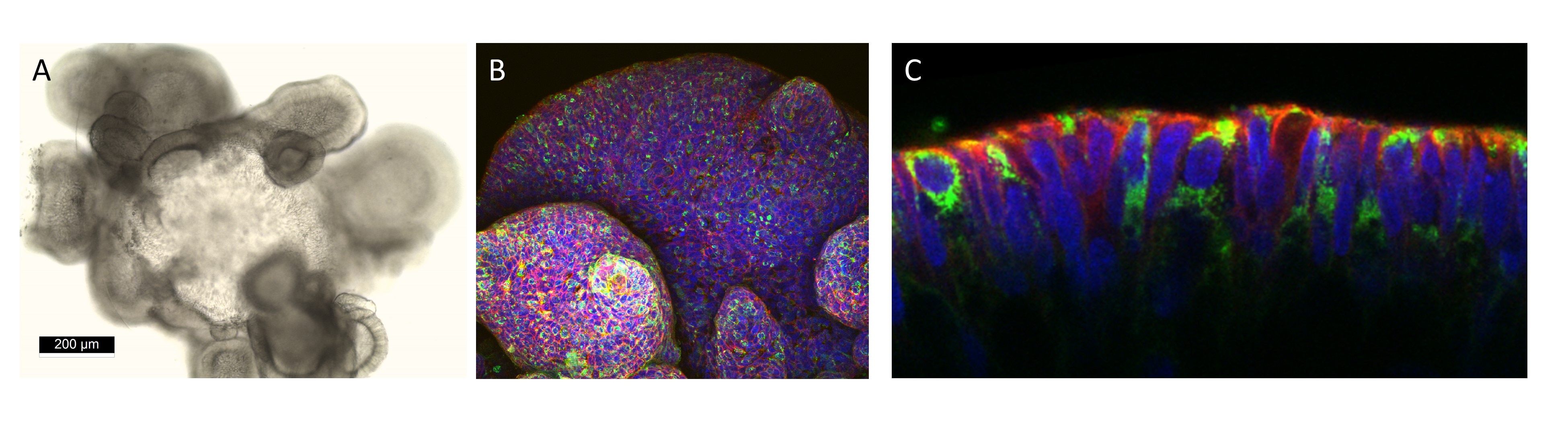 Human Descending Colon Organoids Grown in Cultrex UltiMatrix RGF BME