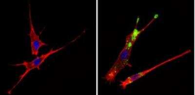 Immunocytochemistry/ Immunofluorescence: c-Abl Antibody (8E9) [NBP2-49695]