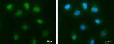 Immunocytochemistry/ Immunofluorescence: c-Abl Antibody [NBP2-15631]