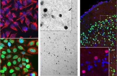 Immunocytochemistry/ Immunofluorescence: c-Fos Antibody (2H2) [NBP2-50037]