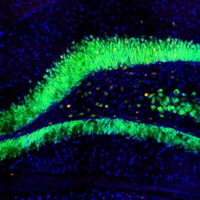 Immunocytochemistry/ Immunofluorescence: c-Fos Antibody (2H2) [NBP2-50037]