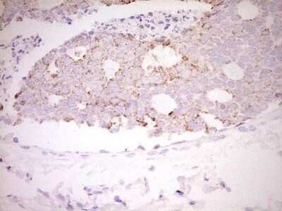 Immunohistochemistry: c-Fos Antibody (OTI7D6) - Azide and BSA Free [NBP2-70764]