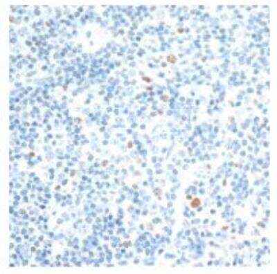 Immunohistochemistry: c-Maf Antibody (BLR045F) [NBP3-14672]