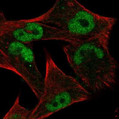Immunocytochemistry/ Immunofluorescence: c-Myc Antibody [NBP2-56660]