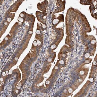 Immunohistochemistry-Paraffin: c-Myc-responsive protein Rcl Antibody [NBP1-85181]