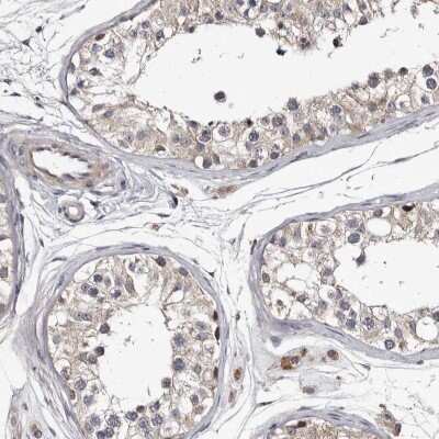 Immunohistochemistry-Paraffin: c-Myc-responsive protein Rcl Antibody [NBP1-85181]
