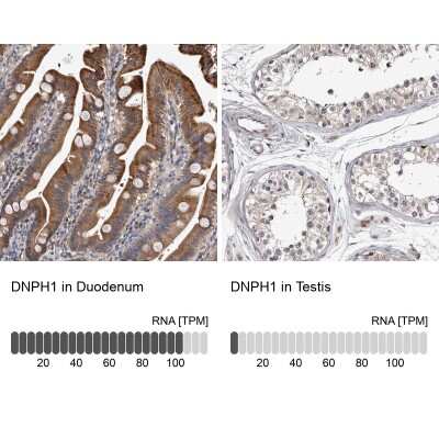 Immunohistochemistry-Paraffin: c-Myc-responsive protein Rcl Antibody [NBP1-85181]