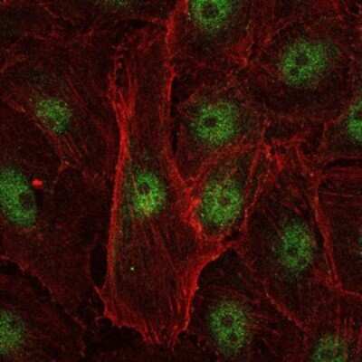 Immunocytochemistry/ Immunofluorescence: c-Rel Antibody (1E7) - BSA Free [NBP2-37593]