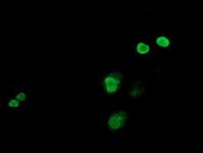 Immunocytochemistry/ Immunofluorescence: c-jun Antibody (OTI3G2) - Azide and BSA Free [NBP2-71059]