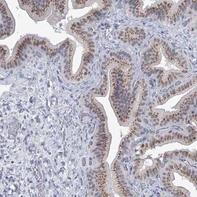 Immunohistochemistry-Paraffin: Eva-1 Homolog C Antibody [NBP1-88937]