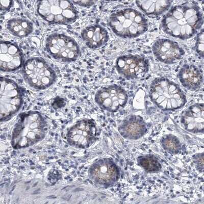 Immunohistochemistry-Paraffin: Eva-1 Homolog C Antibody [NBP1-88937]