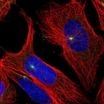 Immunocytochemistry/ Immunofluorescence: cGAS Antibody [NBP2-55374]
