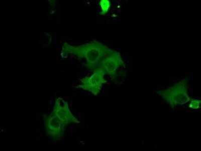 Immunocytochemistry/ Immunofluorescence: cGK1/PRKG1 Antibody (OTI9G4) - Azide and BSA Free [NBP2-71227]