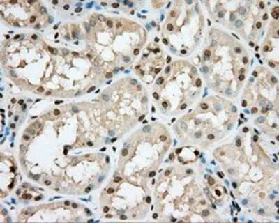 Immunohistochemistry: cGK1/PRKG1 Antibody (OTI9G4) - Azide and BSA Free [NBP2-71227]