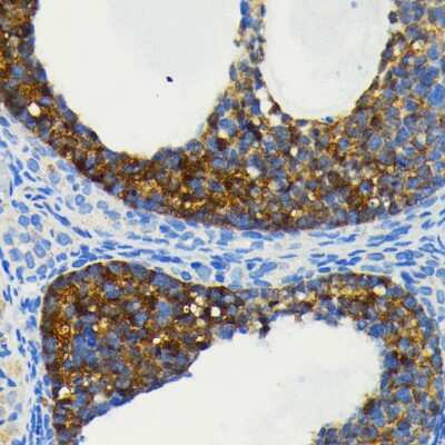 Immunohistochemistry-Paraffin: cIAP-1/HIAP-2 Antibody (2L0W9) [NBP3-15860]