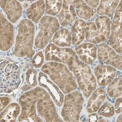 Immunohistochemistry-Paraffin: cIAP-1/HIAP-2 Antibody [NBP1-90133]
