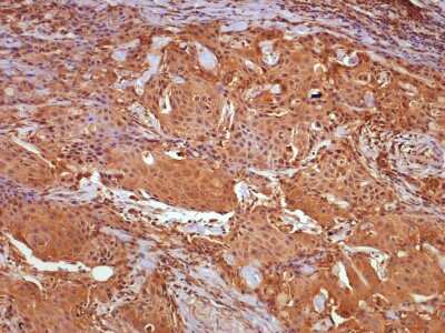 Immunohistochemistry-Paraffin: cIAP-2/HIAP-1 Antibody - BSA Free [NBP1-27972]
