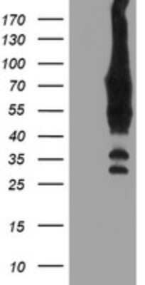 Western Blot: cIAP-2/HIAP-1 Antibody (OTI1A9)Azide and BSA Free [NBP2-70184]