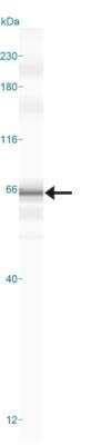 Simple Western: cIAP-2/HIAP-1 AntibodyBSA Free [NBP1-27972]