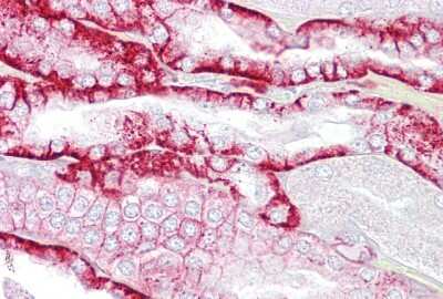 Immunohistochemistry-Paraffin: Cadherin-16 Antibody [NBP1-59248]
