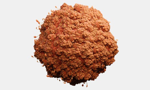 Image of a tumor