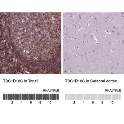 Immunohistochemistry-Paraffin: carabin Antibody [NBP2-49616]