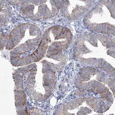 Immunohistochemistry-Paraffin: carboxylesterase 4A Antibody [NBP1-90638]