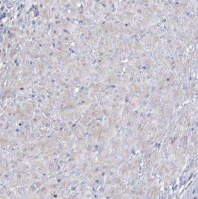 Immunohistochemistry-Paraffin: carboxylesterase 4A Antibody [NBP1-90638]