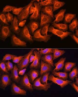 Immunocytochemistry/ Immunofluorescence: ch-TOG Antibody - BSA Free [NBP2-92555]